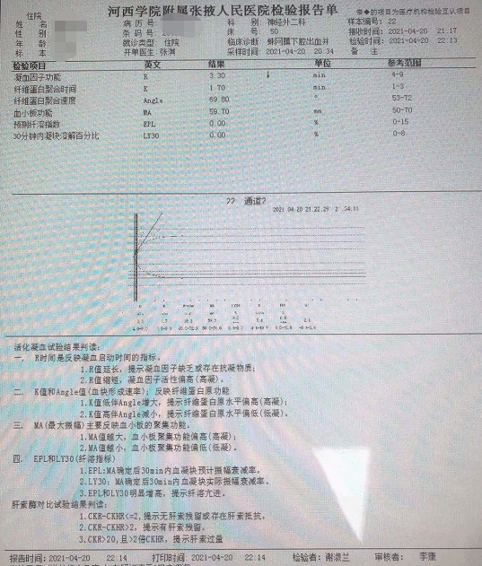 监视器的功能