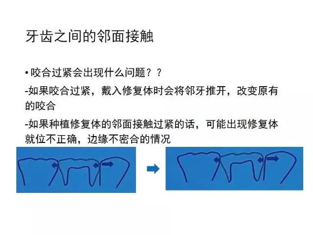 扶手带松紧调节